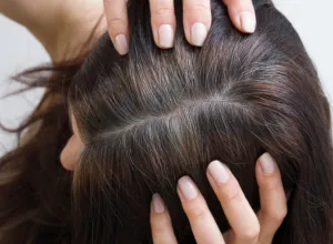 evitar las canas